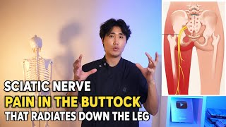 Your sciatic nerve will stop hurting after this video. Do it once and forget the pain.