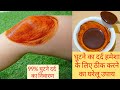 एक रात में मेरा 20 साल पुराना घुटनों का दर्द ठीक हो गया | आप भी जरूर अपनाएं? Knee Pain Treatment