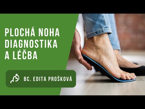 Video: Jak diagnostikovat ploché nohy?