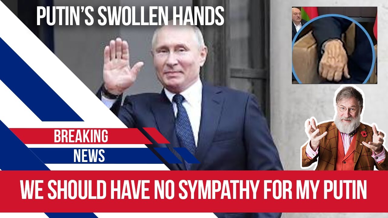 Опухшие руки господина Путина — крючки для печенья в беспорядке.