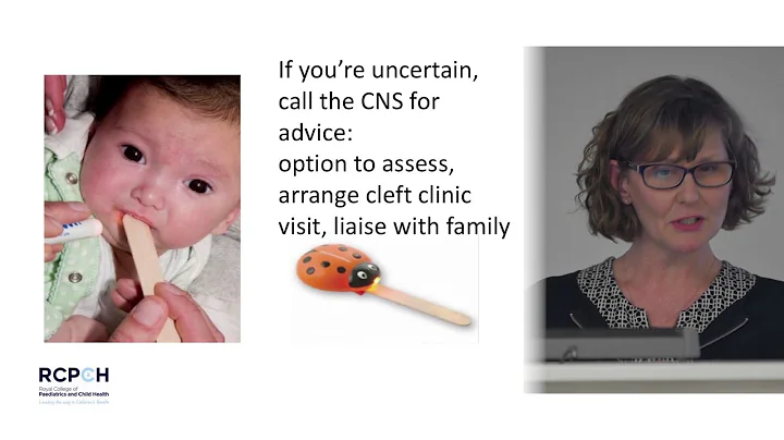 Cleft Palate 6: Julie Hughes  The Role of the Clin...