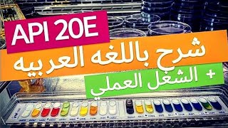 API 20E technique (Analytical profile index)  شرح إختبار وتحليل النتايج