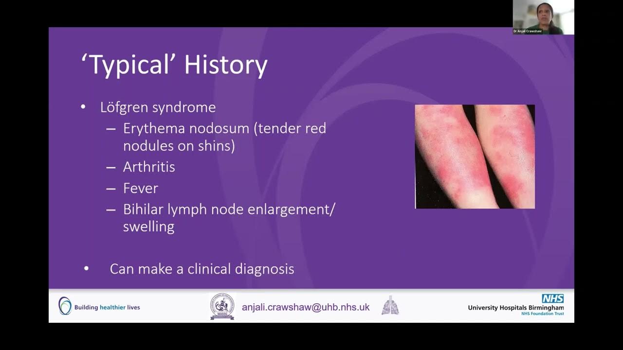 SPD 2022 Session 1 Recently published clinical practice guidelines