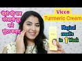 Vicco Turmeric WSO Cream Review || सुन्दर , गोरी त्वचा के लिए इसे लगाएं