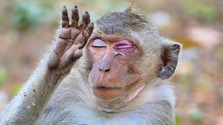 Oh God... Pitiful Adorable Monkey SANTO. He Is Painful Of His Injured Eye.