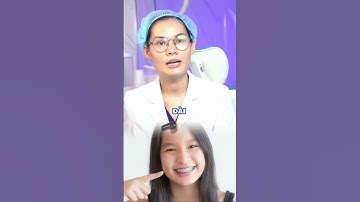 Độ tuổi niềng răng tốt nhất? 30 tuổi có niềng răng được hay không?