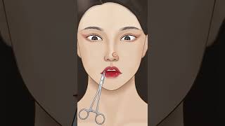ASMR Treatment nose piercing infection p1 #asmr #animation #satisfying #viral #shorts #trending