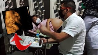 Begini Penampakan Bayi Sangat Jelas Saat USG Kehamilan Jalan 9 Bulan