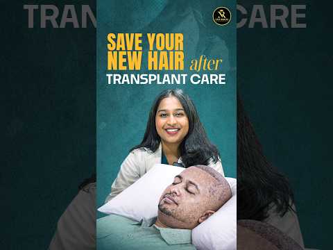 First 30 Days Are Critical 😮 | Hair Transplant Care #hairtransplantcare #shorts