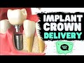 Implant Crown Delivery TIPS | Screw Retained Implant Crowns