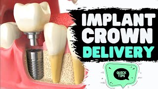 Implant Crown Delivery Tips | Screw Retained Implant Crowns