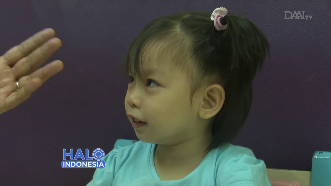 Peduli Anak Cerebral Palsy