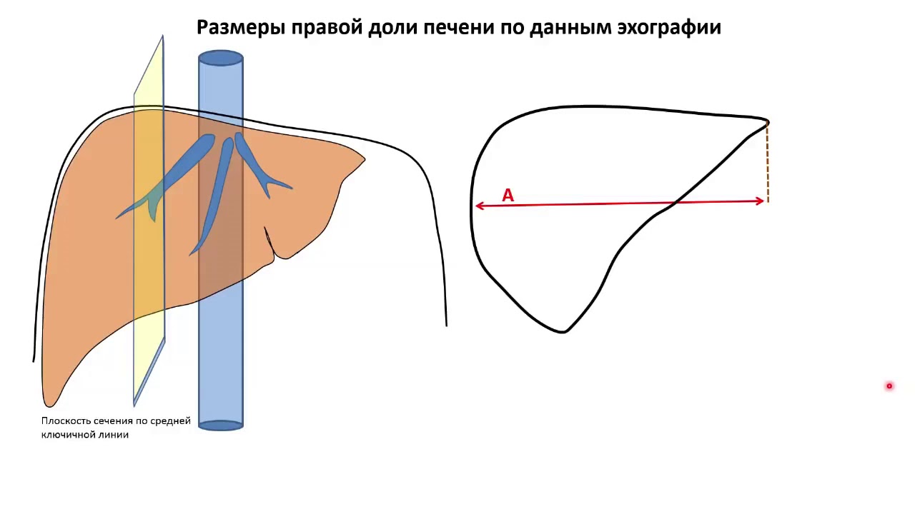 Размеры печени . - YouTube