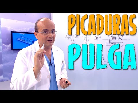 Видео: Picaduras De Pulgas: Síntomas Y Tratamientos