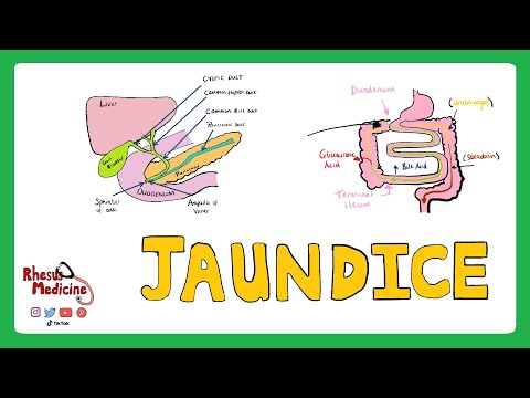 Video: Kulit Kuning (Jaundis): Gambar, Gejala, Punca, Dan Diagnosis