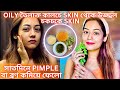 Oily   skin    skin  pimple     skin care