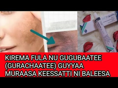 KIREMA FULA NU GUGUBAATEE GURACHAATEE GUYYAA MURAASA KEESSATTI NI BALEESA
