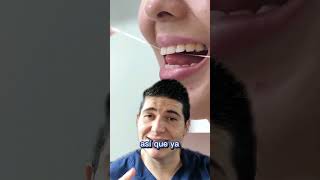 😱por no usar el Hilo dental #cariesdental