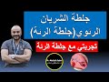 ٢٧ جلطة الشريان الرئوي الجلطة الرئوية تجربتي مع جلطة الرئة ونصائح مهمة للمرضى والأطباء