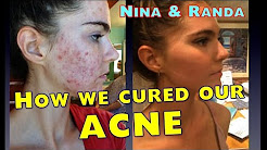 How We CURED Our ACNE - Nina and Randa