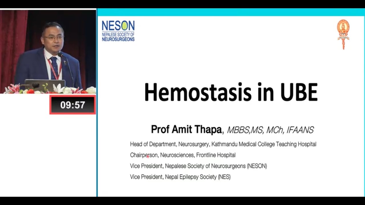 Hemostasis in Uniportal biportal endoscopy (UBE)