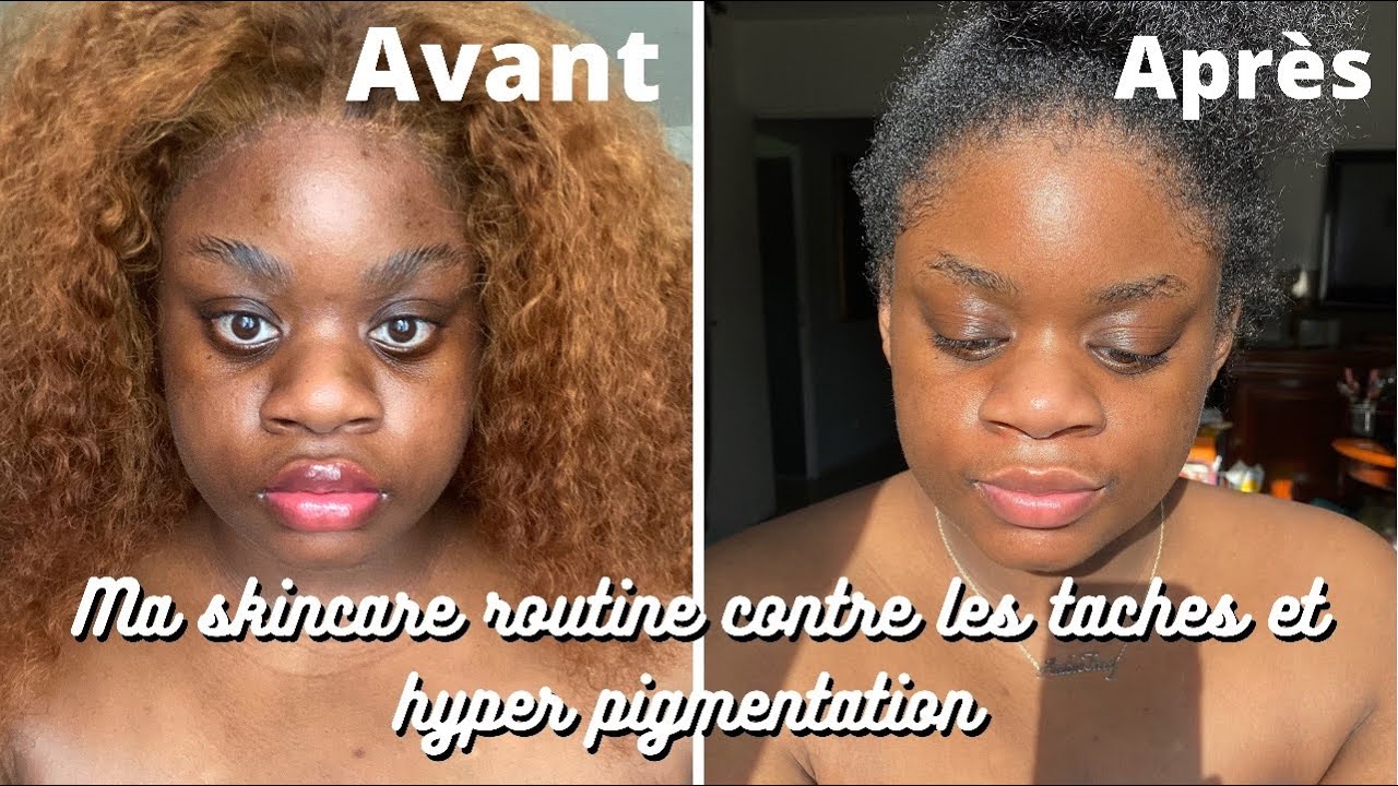 Enfin une Skincare routine qui fonctionne ! YouTube