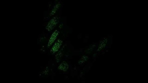 Timelapse of C.Elegans transgene