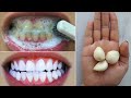 Teeth whitening in seconds removes yellowing and removes accumulated lime💯