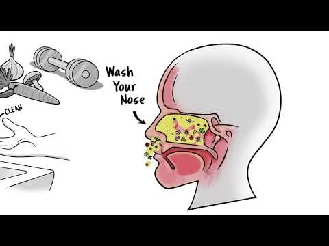 वीडियो: क्या नाक धोने से दर्द होता है?