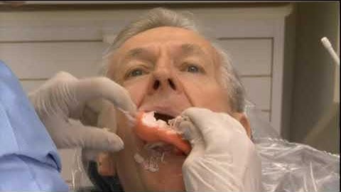 Denture Bootcamp Series Part II: Impression Taking Technique