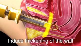 Vogue Feminine Rejuvenation