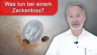 Kann man sich gegen Borreliose impfen lassen?
