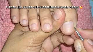 BASIC PEDICURE PART 2/ DRYSKIN REMOVAL