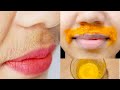 होठों के ऊपर के बाल Upper Lips Hair एक बार हटाने के बाद वापस कभी नहीं आएंगे | Facial Hair Treatment