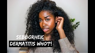 Natural Hair | Sebborheic Dermatitis Care | My Scalp Is Clearing Up?!