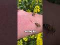 What Should You Do After A Bee Sting?! 🐝🚑😮