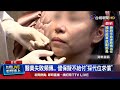 健保給付問題