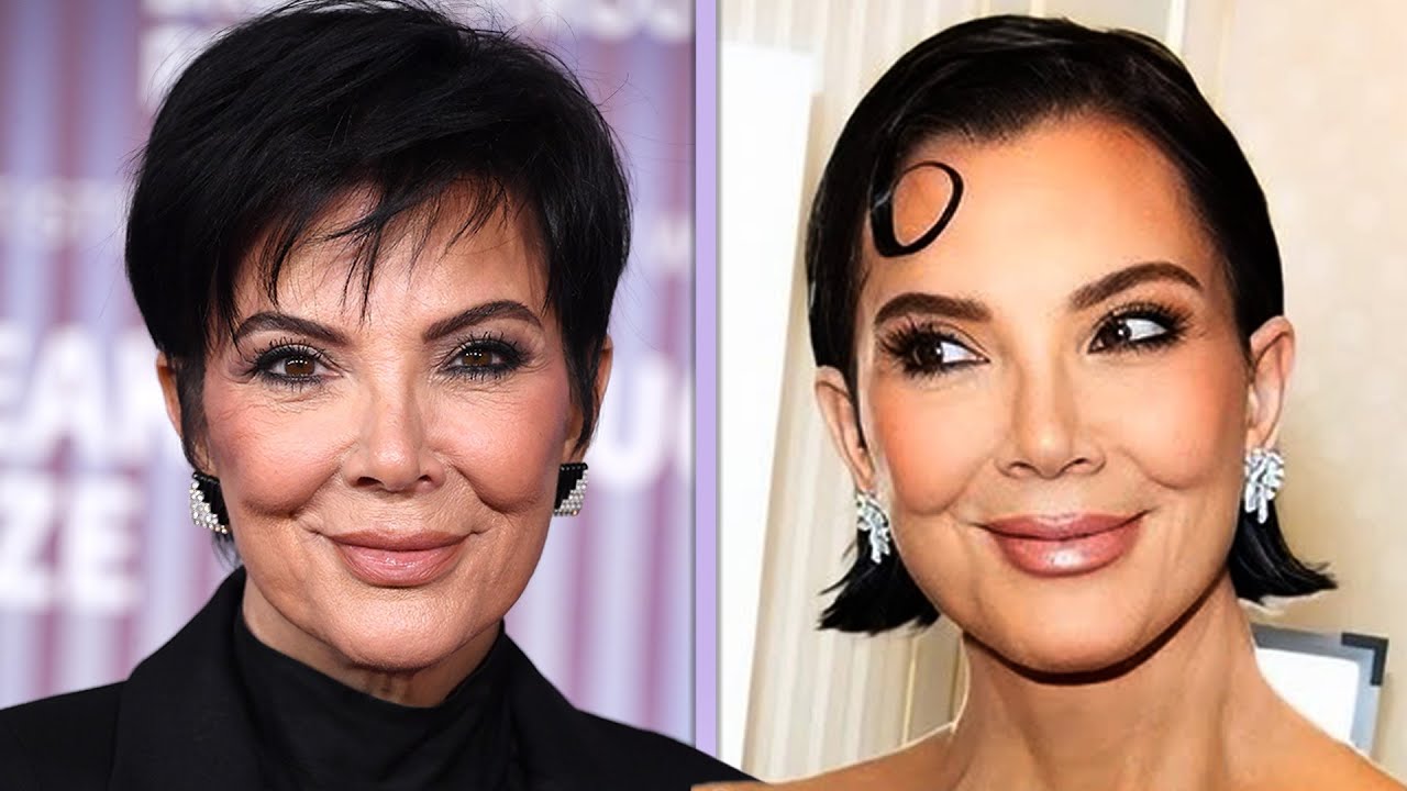 Kris Jenner’s Plastic Surgeon REVEALED as Star Sports Fresh Look Kris Jenner’s Plastic Surgeon REVEALED as Star Sports Fresh Look