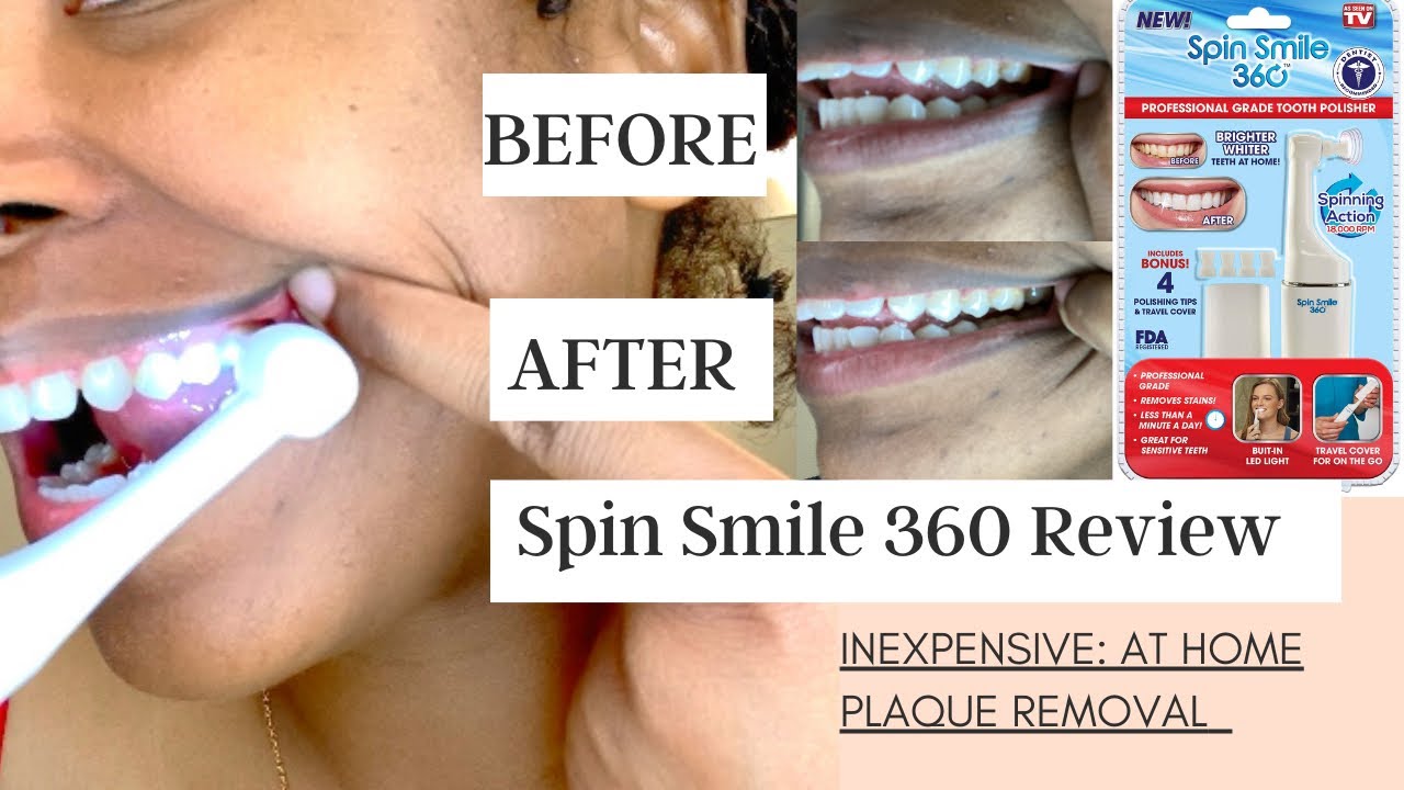 How to remove plaque Rotten Teeth? Stained Teeth Spin Smile 360