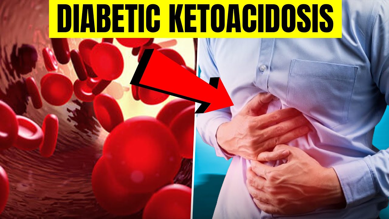 What is Diabetic Ketoacidosis | How to control it