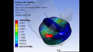 Finite Element Analysis of Tibial Cushion polymers (UHMWPE PEEK PMMA) in ANSYS: Ruskin Dissertation