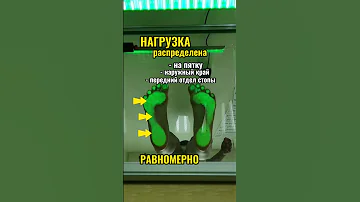 ТАК ВЫГЛЯДЯТ идеальные стопы!