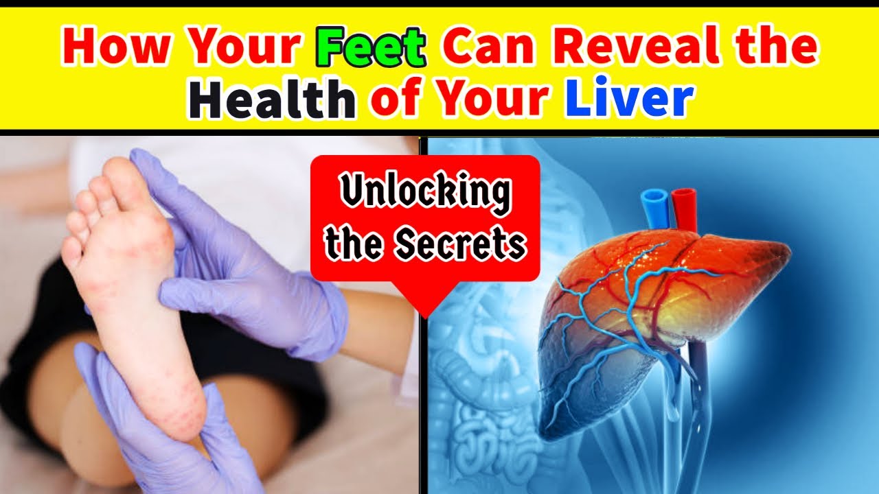 What Feet Tell About Liver Health I Warning Signs I Liver Cancer I
