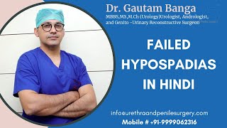 Failed Hypospadias Surgery Information in Hindi | Dr. Gautam Banga | failed hypospadias repair