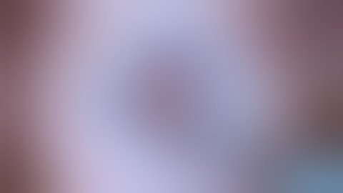 Femtosecond Laser Assisted Cataract Surgery in a Small Pupil using Ziemer Z8 and Malyugin Ring