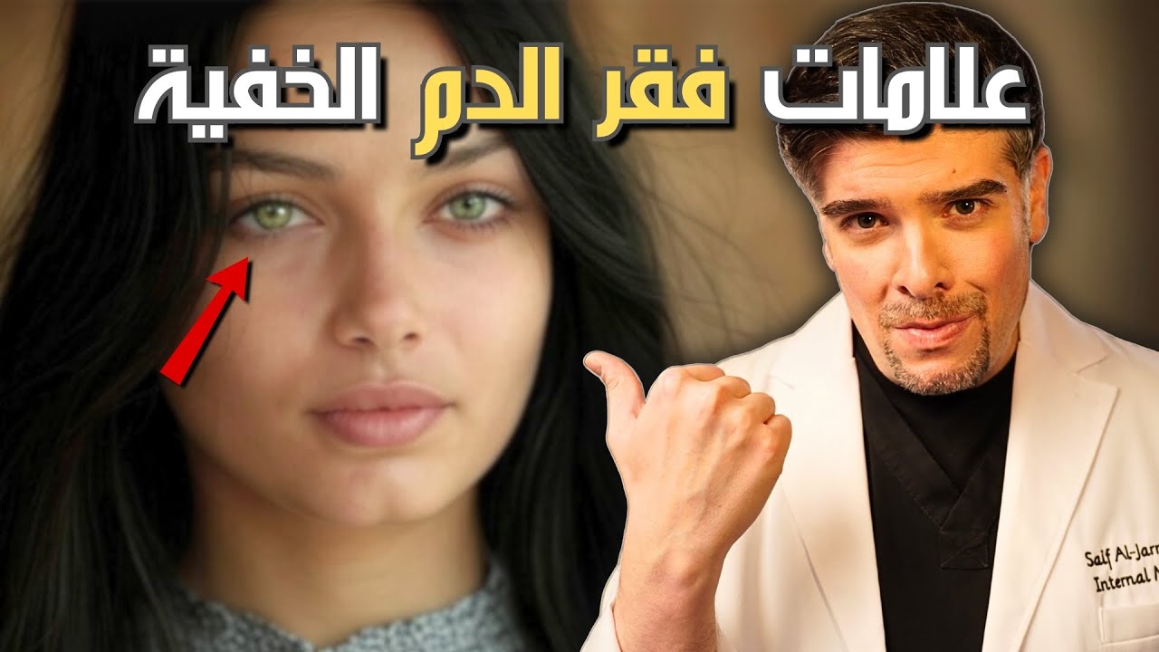 احذر: 10 علامات غريبة على فقر الدم (و اقوى علاج طبيعي)