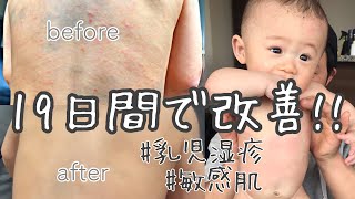 [乳児湿疹・敏感肌]ウルトラファインバブル、ナノバブル&洗濯マグちゃんで肌は改善する？BollinaWideボリーナワイド/市澤の洗濯ウォッシュ取り付け方法/UFB