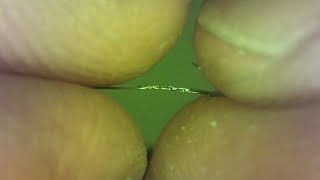 0.004 Nitinol Wire Seam Weld with Laser Welding System