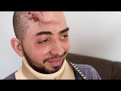 Thumbnail do vídeo: Jovem que sofreu acidente por falta de sinalização pede ajuda
