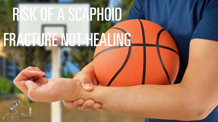 What's the risk if a scaphoid fracture didn't heal?